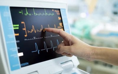EKG-Monitor zeigt Pulswerte an